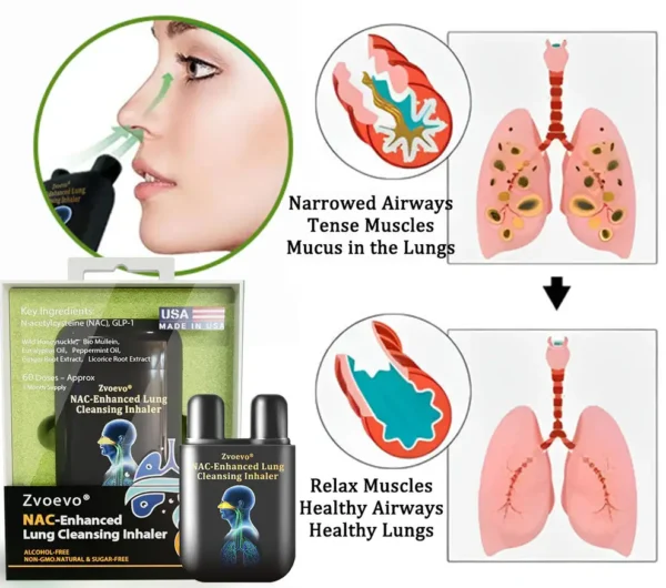 Zvoevo® NAC-Enhanced Lung Cleansing Inhaler
