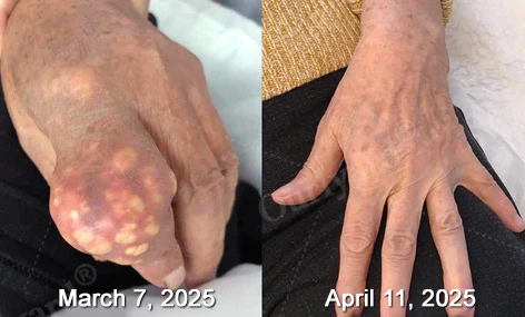 ODALIT™ Magnesium & Peppermint Arthritis Pain Relief and Bone Healing Cream