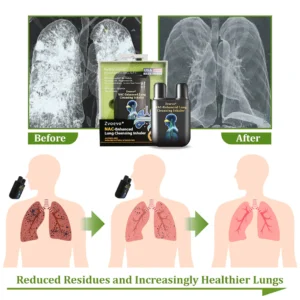 Zvoevo® NAC-Enhanced Lung Cleansing Inhaler