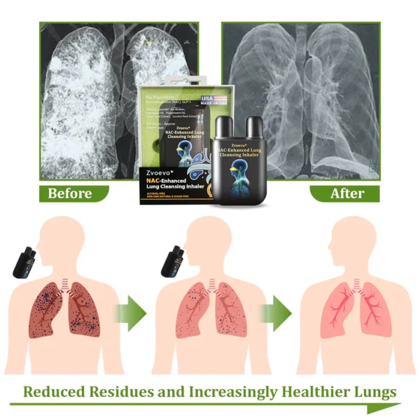 Zvoevo® NAC-Enhanced Lung Cleansing Inhaler
