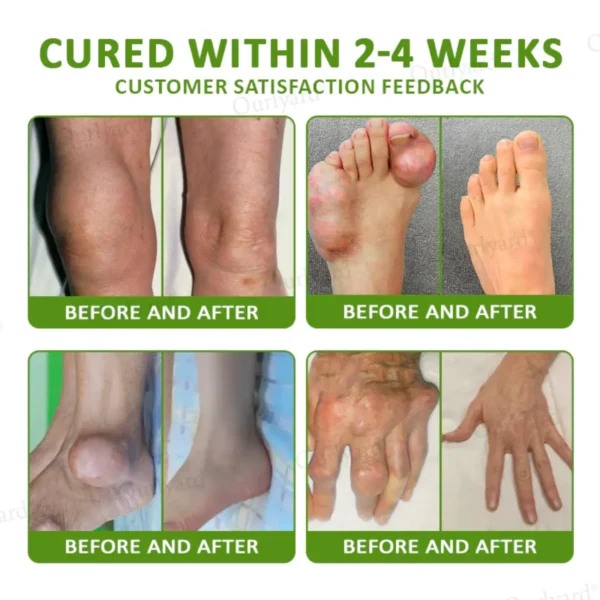 ODALIT™ Magnesium & Peppermint Arthritis Pain Relief and Bone Healing Cream