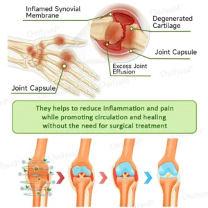 ODALIT™ Magnesium & Peppermint Arthritis Pain Relief and Bone Healing Cream