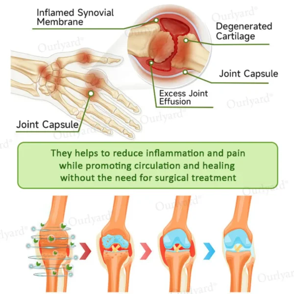 ODALIT™ Magnesium & Peppermint Arthritis Pain Relief and Bone Healing Cream