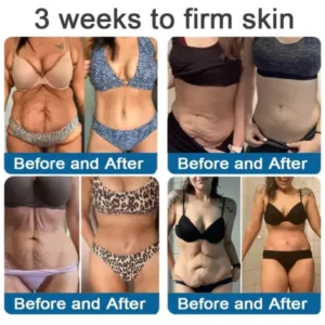 ✅Official Store: Zvoevo® Magnesium Skin Repair Cream (Smooths Wrinkles, Firms Skin and Fades Stretch Marks)
