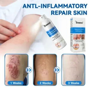 ✅Official Store: Zvoevo®Magnesium Herbal Spray⚕️FDA certified (Relief for Psoriasis and Eczema, Improvement of Bacterial Infections in the Genital Area, and Treatment of Acne and Dark Spots)