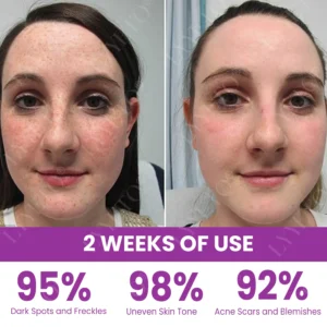 TAILEDEN® MelantraX Advanced Brightening Essence