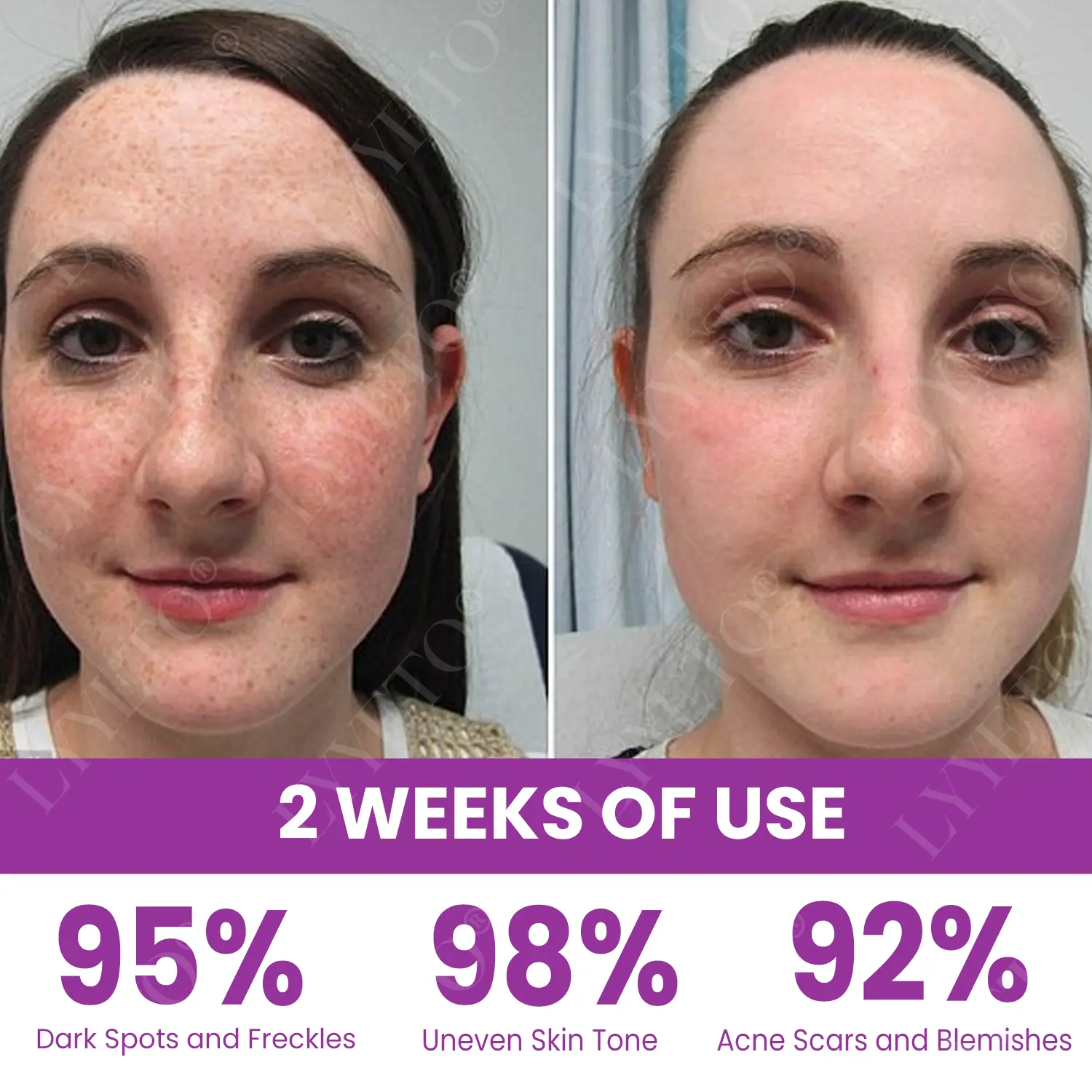 TAILEDEN® MelantraX Advanced Brightening Essence