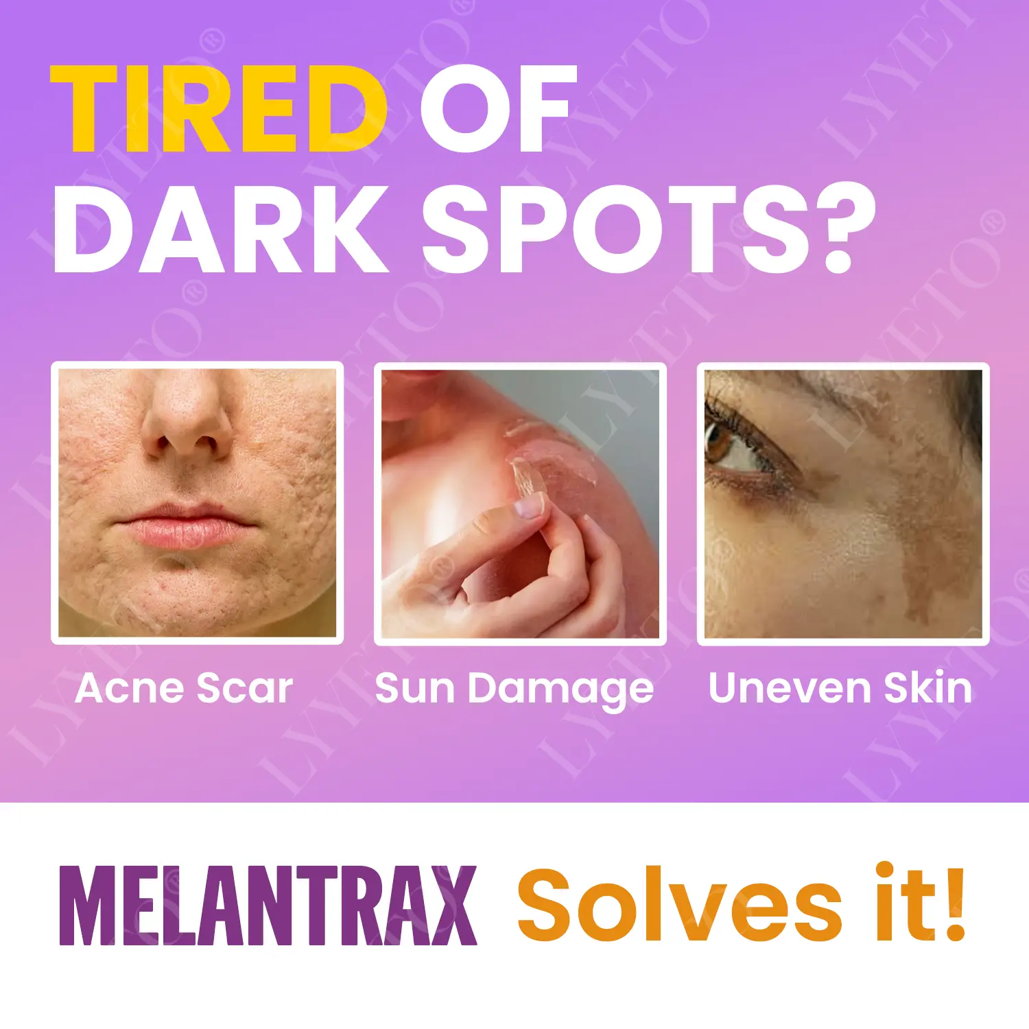 TAILEDEN® MelantraX Advanced Brightening Essence