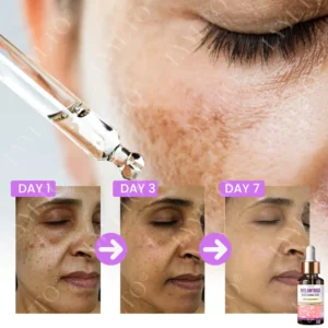 TAILEDEN® MelantraX Advanced Brightening Essence