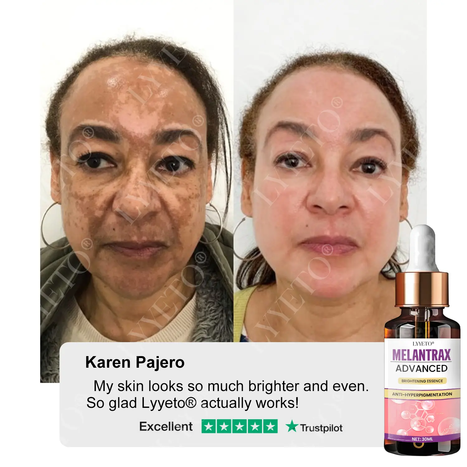 TAILEDEN® MelantraX Advanced Brightening Essence