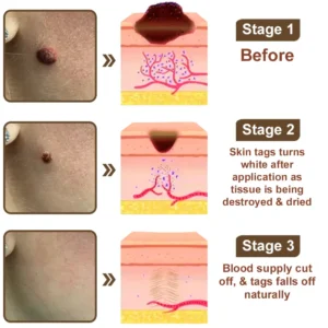 Zvoevo® Rice Bran Essence Cream