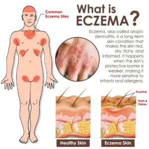 Zvoevo® Tallow Bee Venom Skin Restoration Cream