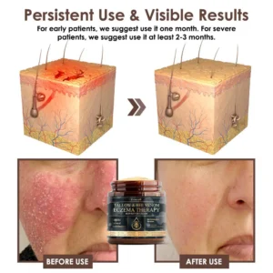 Zvoevo® Tallow Bee Venom Skin Restoration Cream