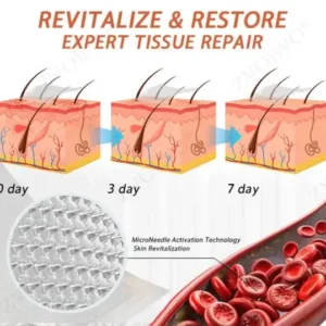 🎁💐Zvoevo® Vein Ease Microneedle Care Patch(For Spider Veins, Varicose Veins, Swelling & Leg Fatigue)