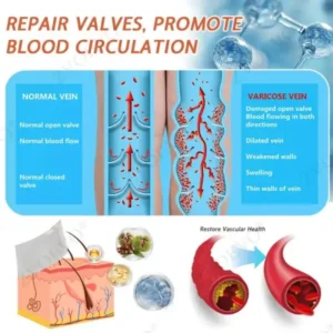🎁💐Zvoevo® Vein Ease Microneedle Care Patch(For Spider Veins, Varicose Veins, Swelling & Leg Fatigue)