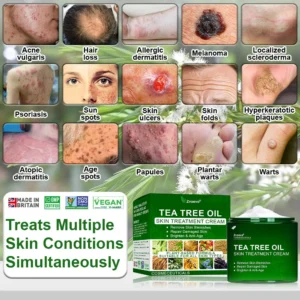 𝐳𝐯𝐨𝐞𝐯𝐨® 𝐓𝐞𝐚 𝐓𝐫𝐞𝐞 𝐎𝐢𝐥 𝐒𝐤𝐢𝐧 𝐓𝐫𝐞𝐚𝐭𝐦𝐞𝐧𝐭 𝐂𝐫𝐞𝐚𝐦