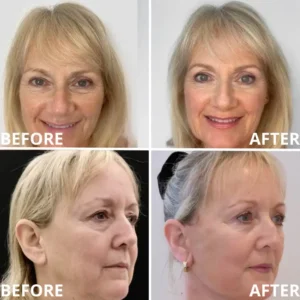 Calcium Multi Balm | Anti-Aging, Firming & Wrinkle Care