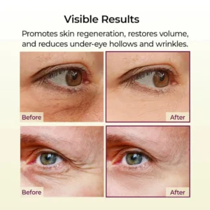 Calcium Multi Balm | Anti-Aging, Firming & Wrinkle Care