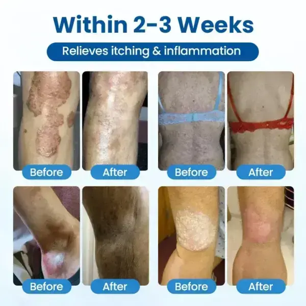 Cougex® PCA Magnesium Deep Repair Spray