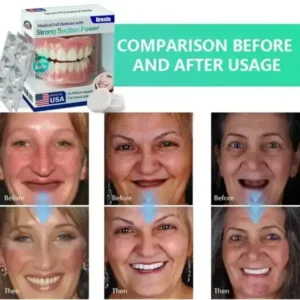 Dresfa® Medical Full Denture with Strong Suction